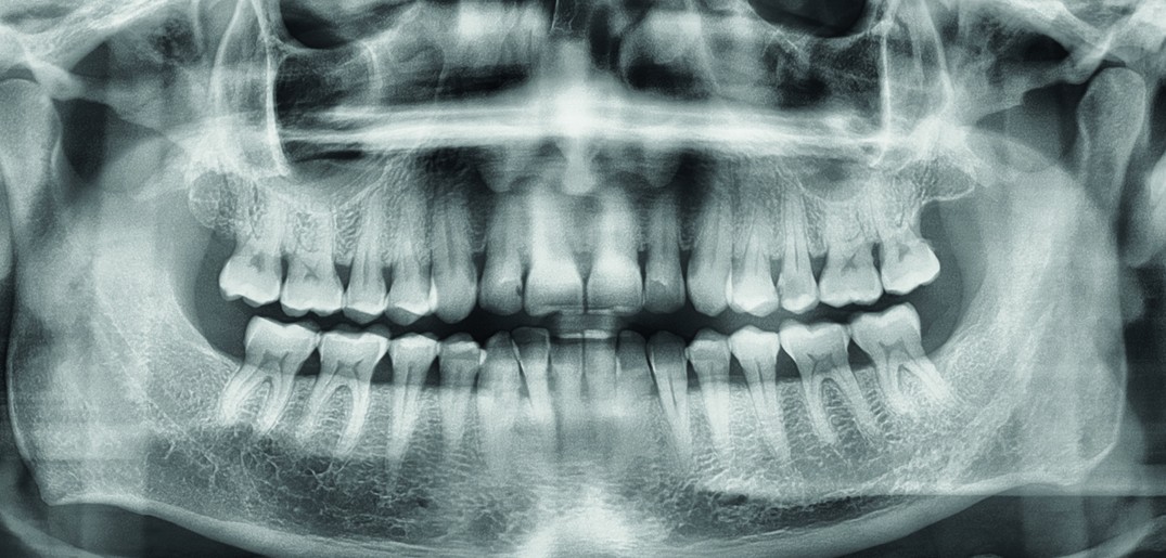 Teeth_xray.jpg