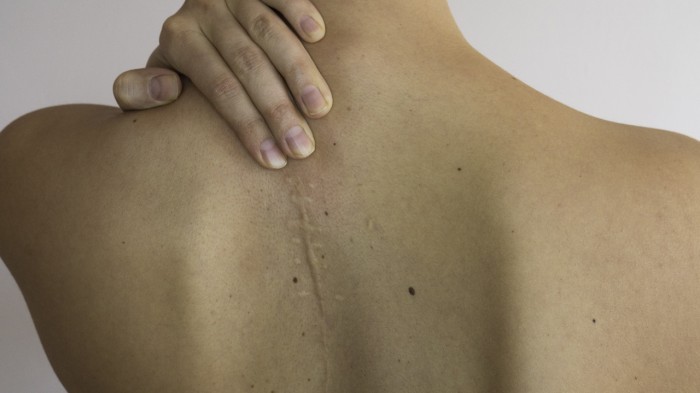 scars.jpg