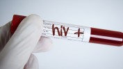 HIV 1280.jpg